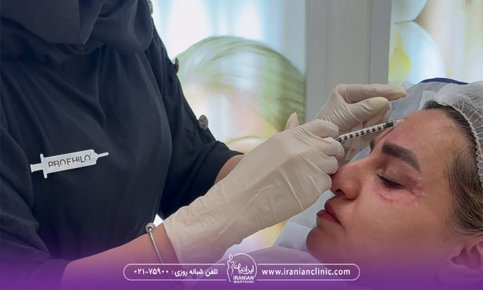 تزریق بوتاکس