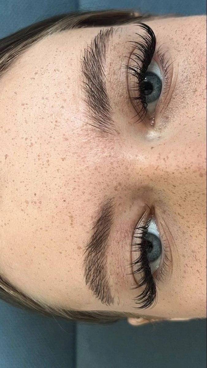 کاشت مژه گربه ای برای پلک های افتاده کاشت مژه گربه ای