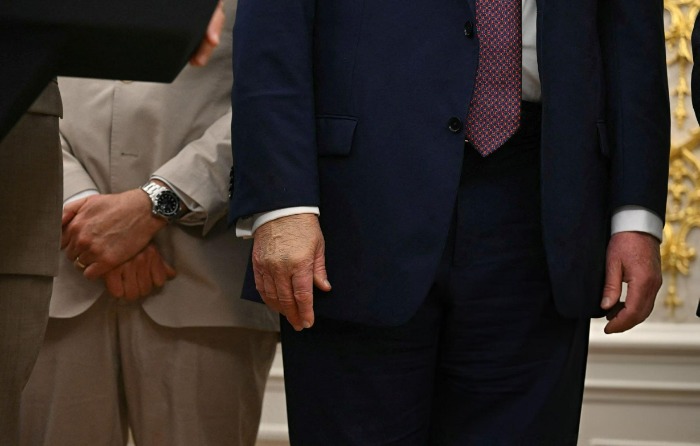 بیماری ترامپ