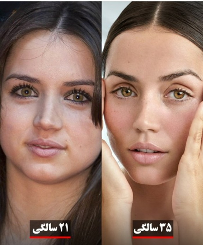 آنا د آرماس قبل از عمل