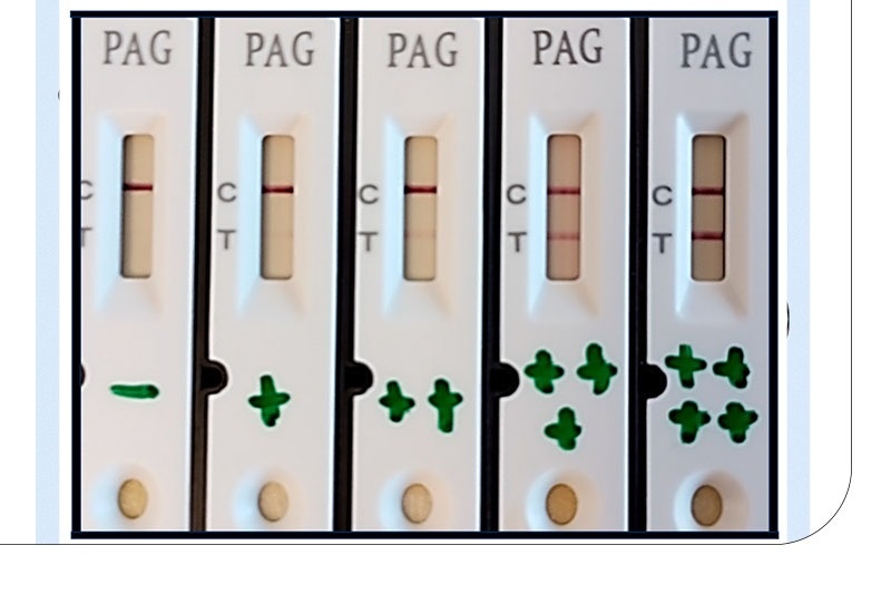 چرا آزمایش خون زودتر از تست خانگی نتیجه می دهد؟
