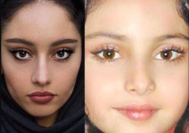 عمل زیبایی ترلان پروانه