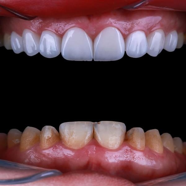 تبلیغات دندانپزشکی