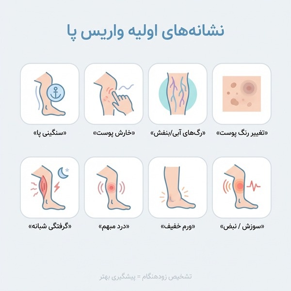 علائم اولیه واریس پا؛ نشانههایی که نباید نادیده گرفته شوند نشانه های اولیه واریس پا