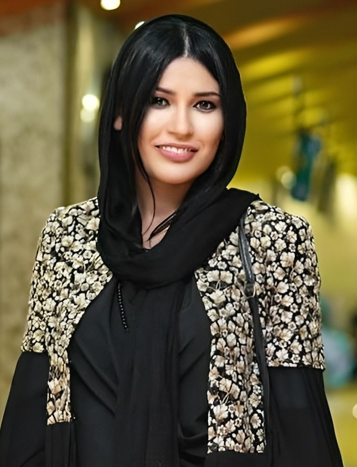 واکنش شیوا طاهری به شایعات عمل زیبایی اش