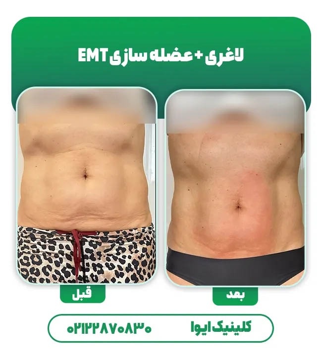 عضله سازی با دستگاه