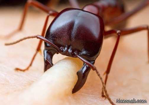 عکس/ لحظه گاز گرفتن مورچه از انسان