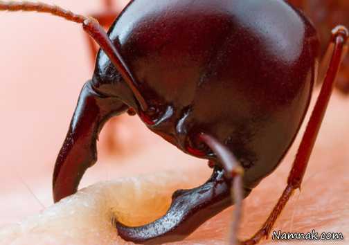 عکس/ لحظه گاز گرفتن مورچه از انسان