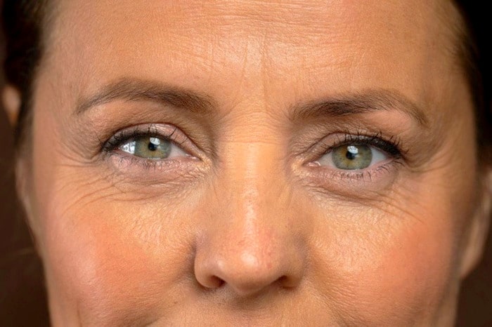 Eyebrow wrinkles