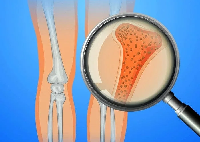 حقایق مصرف مکمل ویتامین ها مکمل و ویتامین