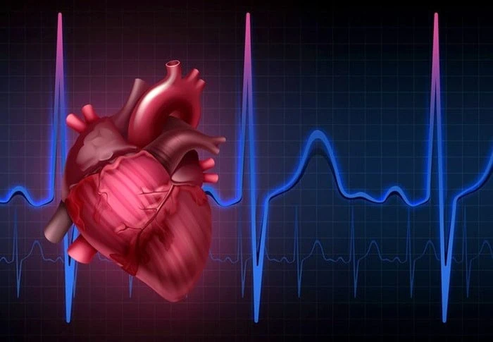 آریتمی قلب