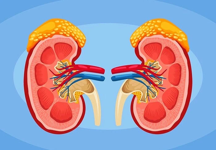 کیست کلیه چه علائمی دارد؟ لاپاراسکوپی کیست کلیه