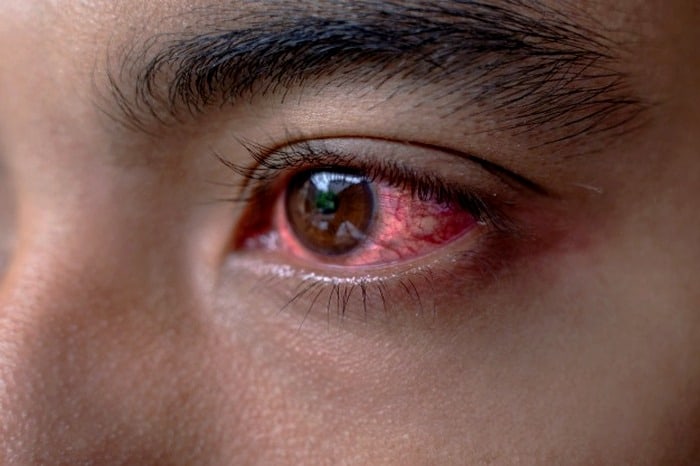 حساسیت چشم به نور و تاری بینایی