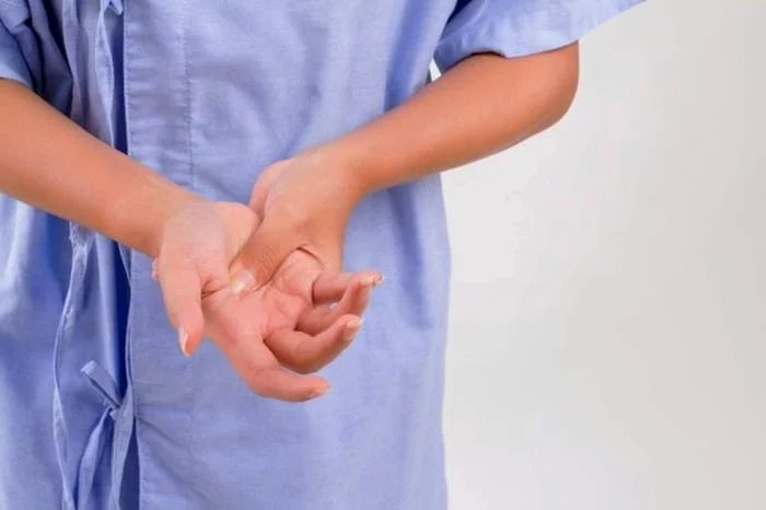 اسکلرودرمی چیست 