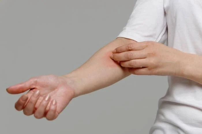 کلستاز بارداری