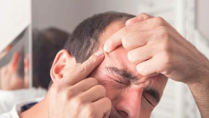 روش صحیح تخلیه جوش