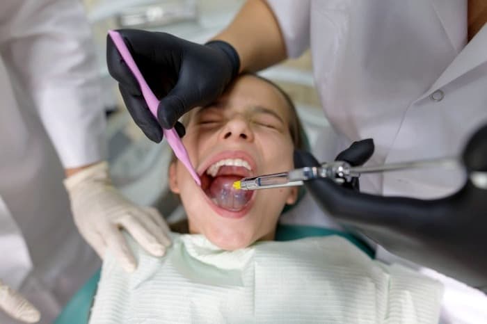 روش های پرکردن دندان 