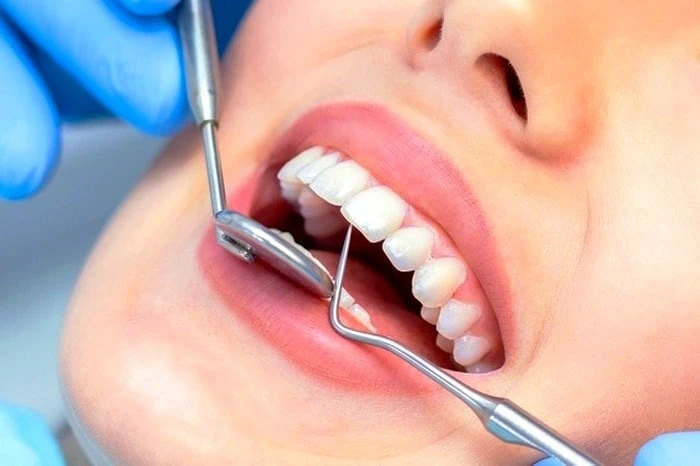 بازیابی مینای دنادن
