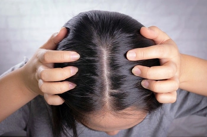 درمان چرب شدن بیش از حد موی سر