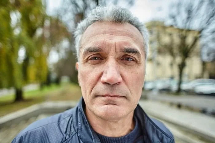 سفید شدن مو