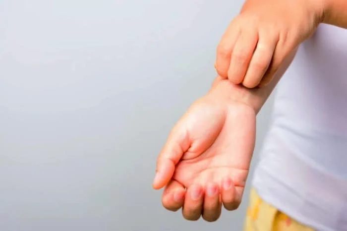 احساس حرکت چیزی زیر پوست