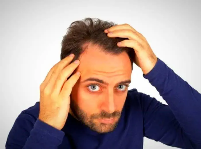 علت ریزش مو
