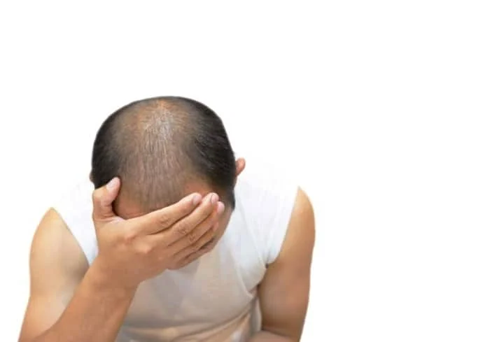 طاسی زودرس
