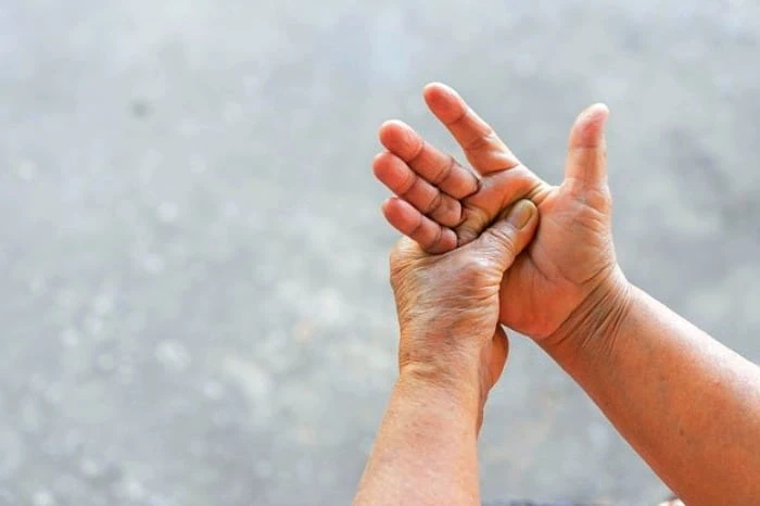 آماس دست