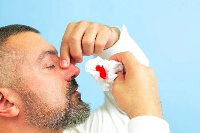 خون دماغ شدن
