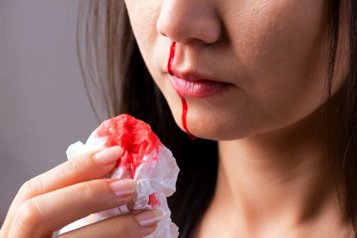  چگونه خونریزی بینی را متوقف کنیم