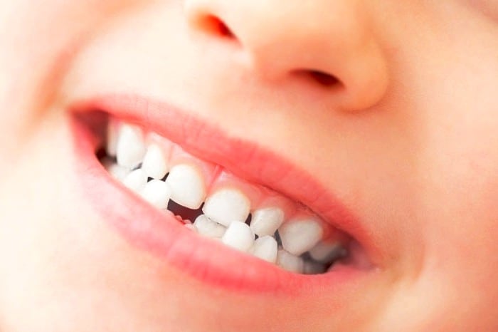نگهداری دندان شیری
