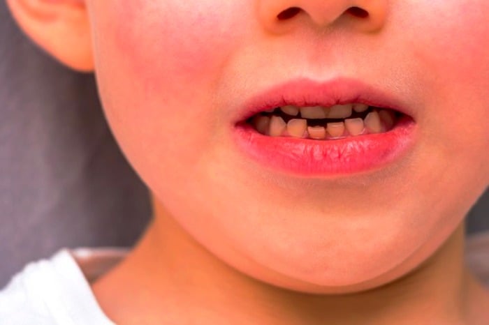 دندان های کودکان