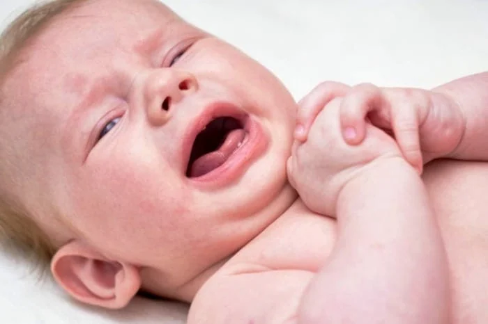 ختنه کردن نوزاد با حلقه