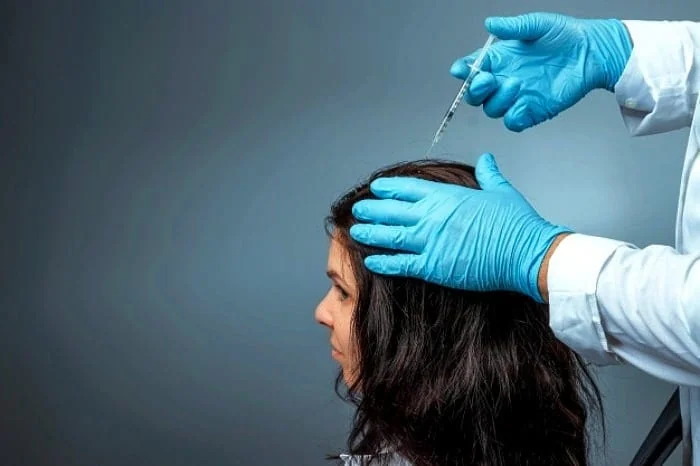 نحوه انجام مزوتراپی مو