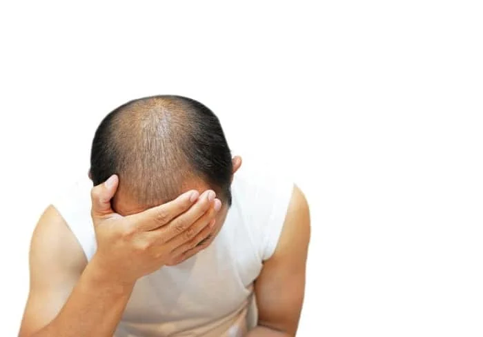 طب سنتی ریزش مو