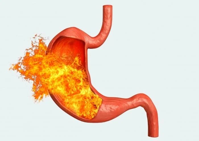 طب سنتی