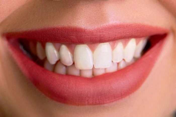 وازلین برای دندان
