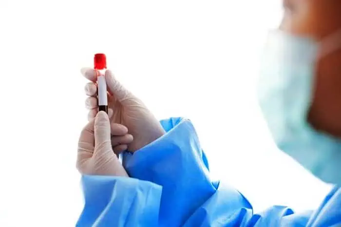 آلدوسترون خون