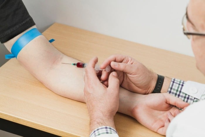 آزمایش تشخیص ایدز عفونت حاد hiv