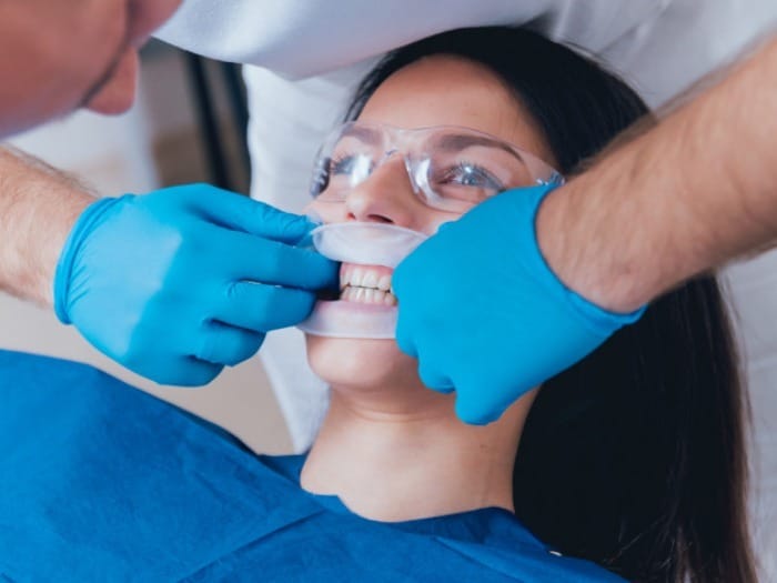 روش لیزر دندانپزشکی