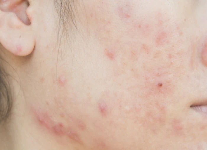 ماسک صورت شیر و ژلاتین