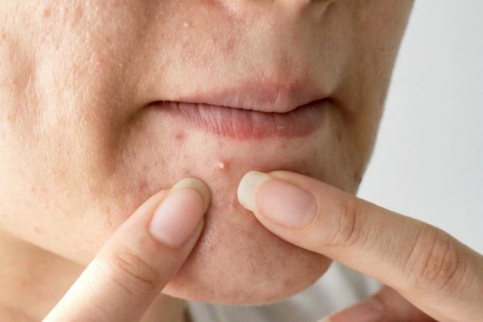 گوجه فرنگی برای جوش