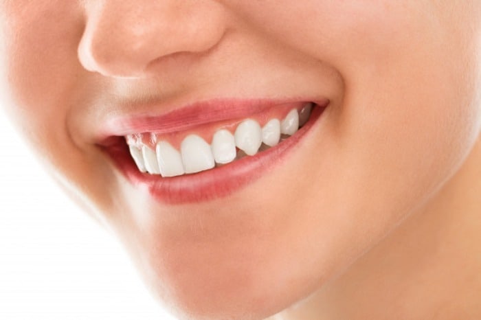 درمان جرم دندان