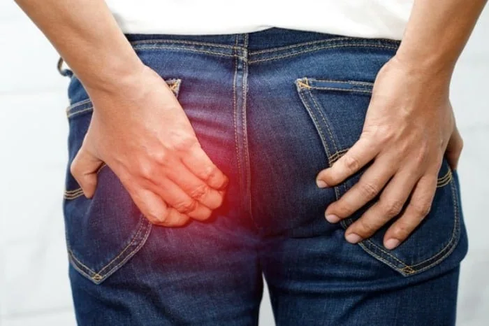 پیشگیری از هموروئید