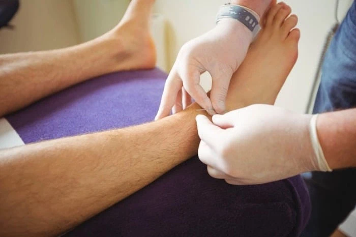 خطرات طب سوزنی