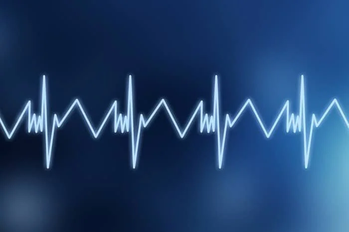 آریتمی قلبی چیست