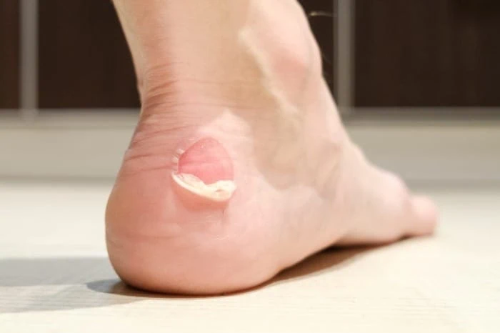 تاول