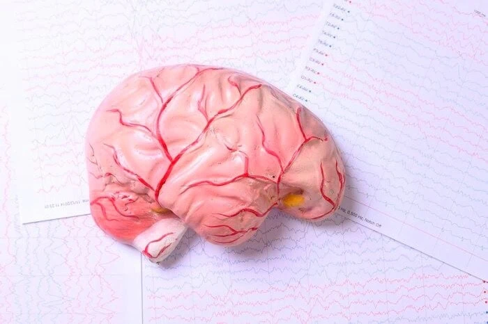 blood vessels