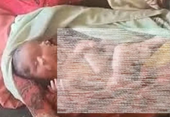 نوزاد عجیب الخلقه
