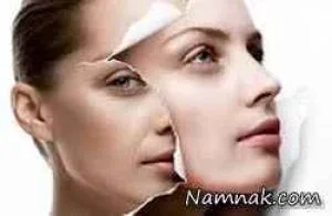 ماساژ پوست صورت